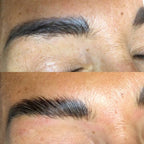 Rilumia - Arganolina Kit