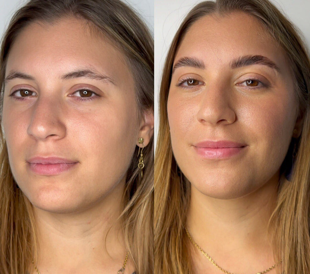 Step 1 e 2 Rilumia