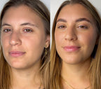 Step 1 e 2 Rilumia