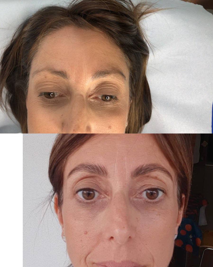 Rilumia - Arganolina Kit