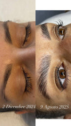 Step 1 e 2 Rilumia