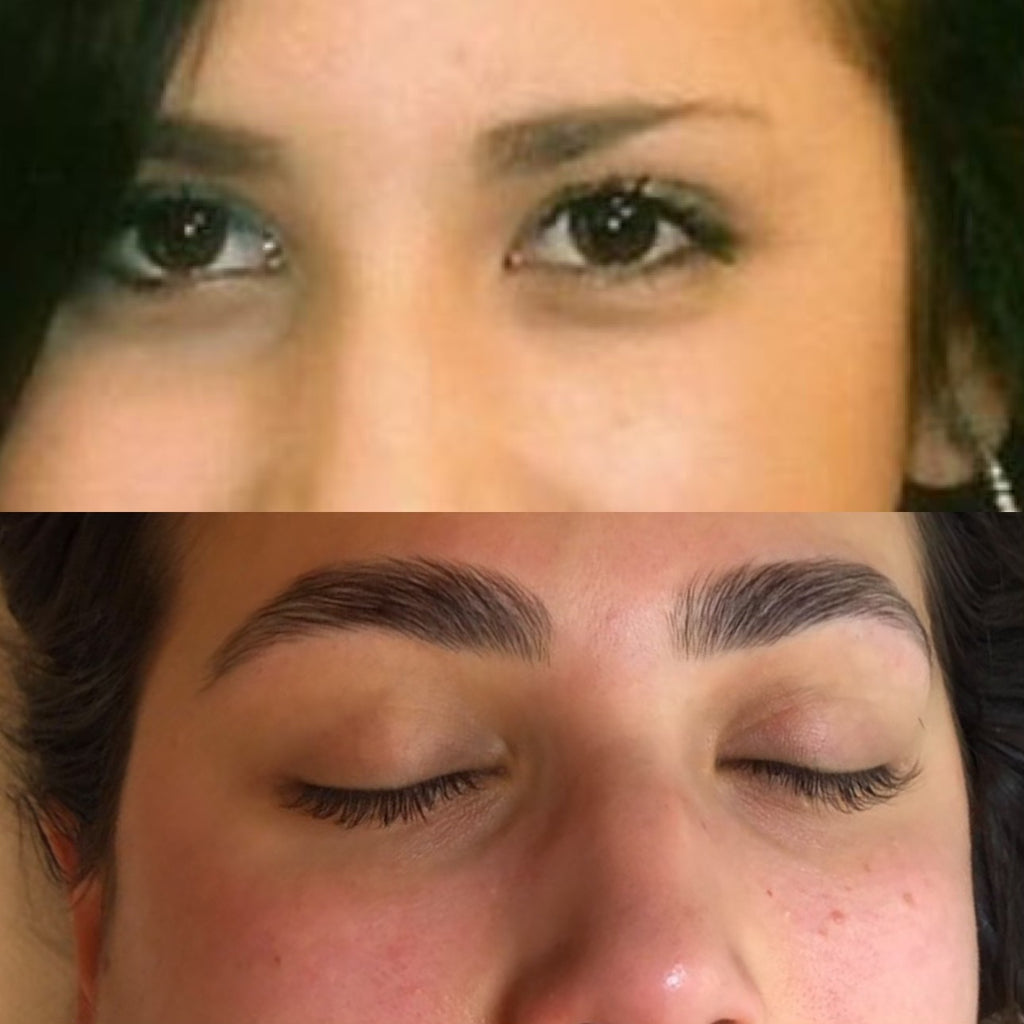 Rilumia - Arganolina Kit